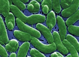 The truth about ‘flesh-eating’ bacteria in our waters … If you don’t feel safe going to the beach, read this item-thumbnail